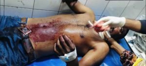 গোয়ালন্দে যুবককে কুপিয়ে জখম