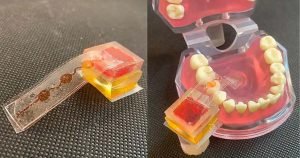 An image of e-test device