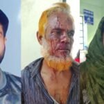 কুড়িগ্রাম ভুরুঙ্গামারীতে যৌতুকের দাবিতে স্ত্রীকে নির্যাতন, শশুরকে কুপিয়ে আহত, থানায় অভিযোগ